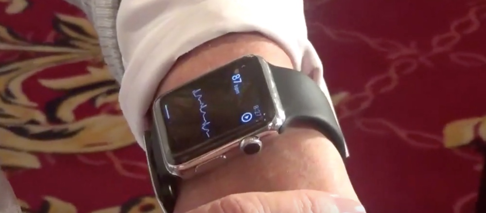 Apple Watch ECG Trial App Unveiled