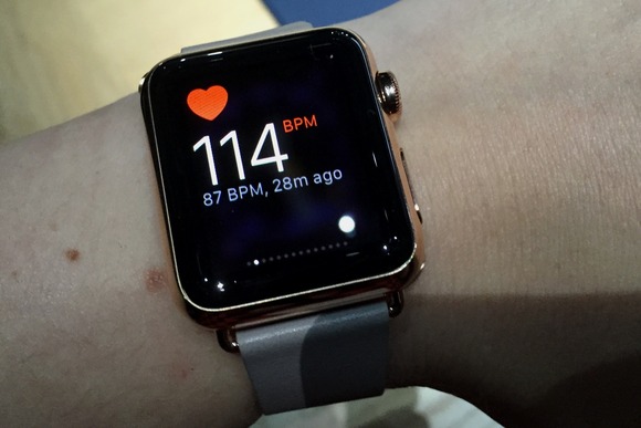 The Apple Watch Saves Another Life
